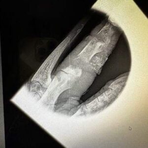 X Ray 1